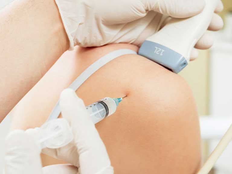 Patient receiving Ozone Therapy at Vitality Integrative Wellness in Temecula for joint pain relief